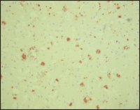 Monoclonal Anti--Amyloid antibody produced in mouse 