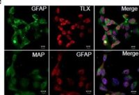 Monoclonal Anti-MAP2 (2a+2b) antibody produced in mouse 
