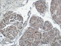Monoclonal Anti-PMP22 antibody produced in mouse 