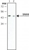 Monoclonal Anti-SNX6 antibody produced in mouse 