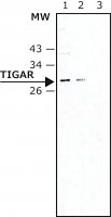 Monoclonal Anti-TIGAR antibody produced in mouse 