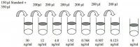 Human IGF-I ELISA Kit RAB0228-1KT