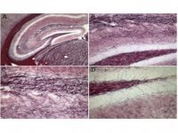 Black Gold II Myelin Staining Kit AG105