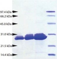 Proteinase 3 from human neutrophils SRP6309-25UG